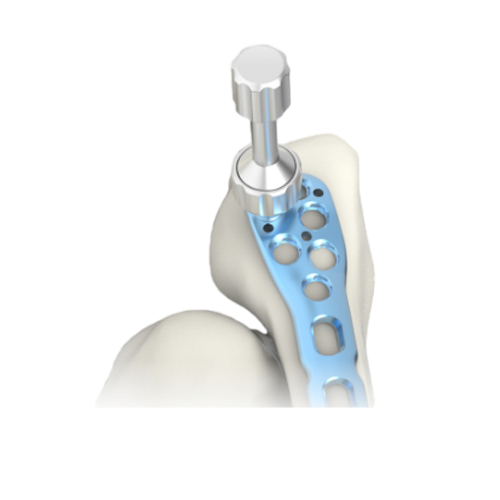 ankle system 2835